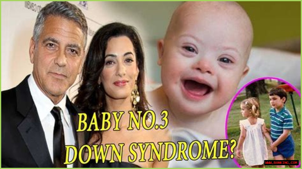 Understanding The Journey: George Clooney's Son And Down Syndrome